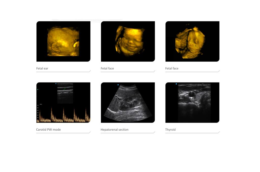 Ultrasound Color Doppler CTS-8800 Plus + 4D convex probe - Image 5