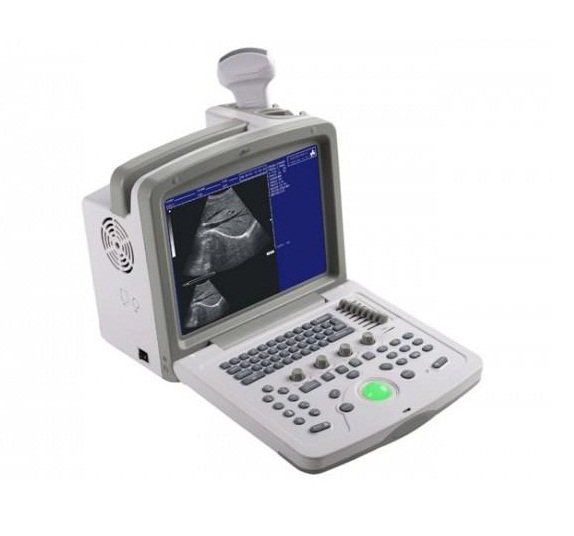 Ultrasound Scanner WED-180