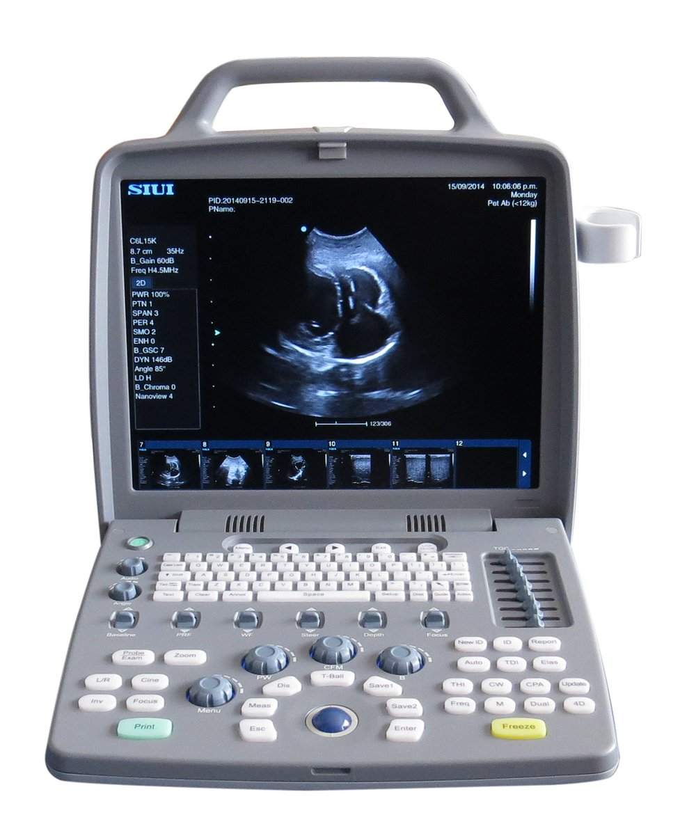 Ultrasound Color Doppler CTS-8800 Plus + 4D convex probe - Image 3