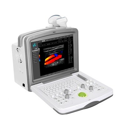 FDC6000 Full Digital Color Doppler Diagnostic System