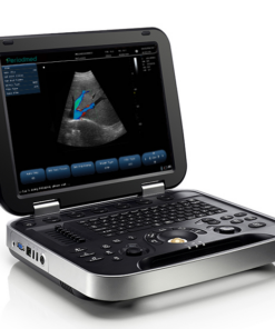 Portable Ultrasound Scanner 15-inch LED display MAS-15L